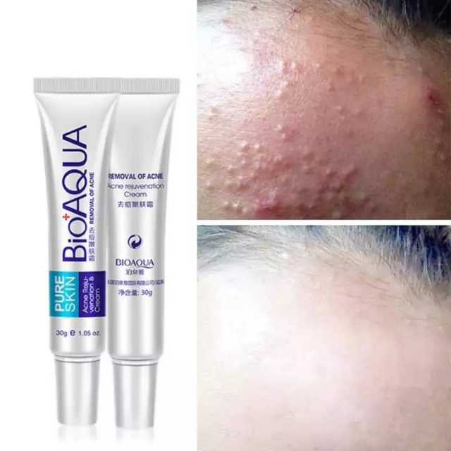 BioAqua acne Removal Cream