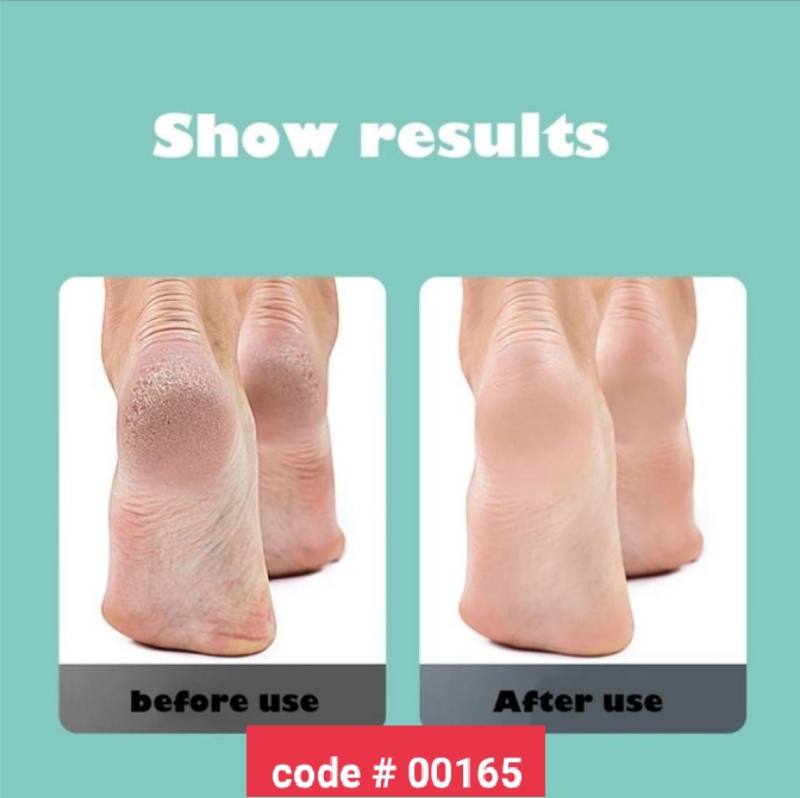 Electric Pedicure Tool Callus Remover With Builtin Vaccum