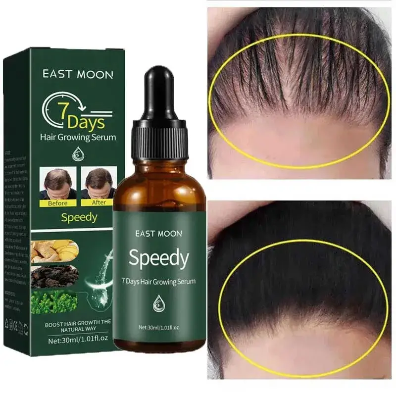7 Days Anti Hair Loss Serum