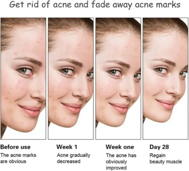 GLUPATONE Emulsion 50ml + Homeo Cure Beauty Cream Pack of 1