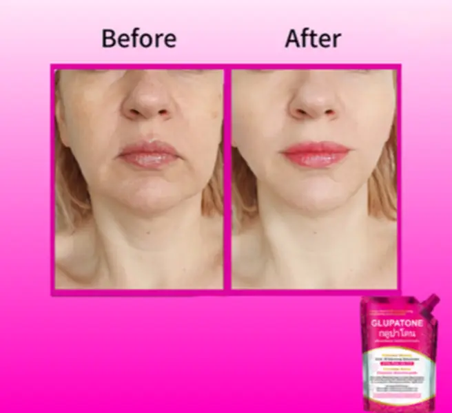 GLUPATONE Emulsion 50ml + Homeo Cure Beauty Cream Pack of 1